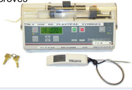 <p>Intravenous opiate - morphine in infusion pump</p><ul><li><p>Patient titrates analgesia for breakthrough pain </p></li><li><p>Limits set for dose and lockout to prevent overdose </p></li><li><p>Can set continuous background if necessary </p></li><li><p>Records 24 hour opiate use</p></li><li><p>As pain decreases can switch to oral, stop oral opioids if still on PCA</p></li><li><p>Monitor opiate toxicity (sedation, respiratory depression, pinpoint pupils) and pain score</p></li></ul><p></p>