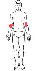 <p>anterior surface of elbow</p>