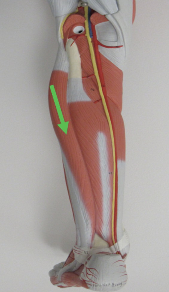 <p><strong>Leg Muscles Identification Practice Quiz (Some muscles are repeated from different angles)</strong></p><p>Identify the muscle indicated by the pointer.</p>