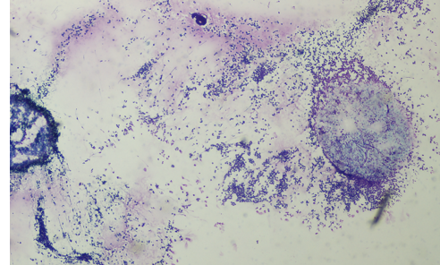 <ul><li><p>section of basophillic cells</p></li><li><p></p></li></ul><p></p>
