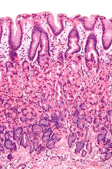 <p><span>What are the key identifying features and primary anatomical location of </span><strong>Simple Columnar Epithelium</strong><span>?</span></p>