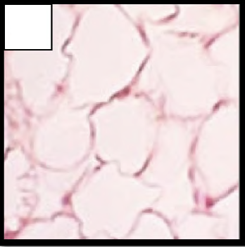 <p>Adipocytes (lipid interior)</p><p>White blobs</p>