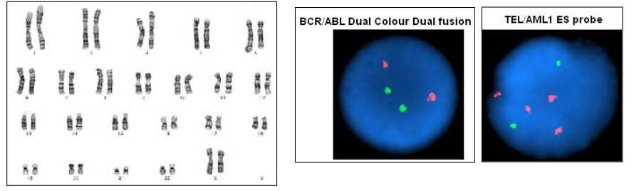 <p>- Test for chromosomes</p><p>- Test for mutations</p><p>.</p><p>Methods performed:</p><p>- Karyotype: full chromosomal analysis</p><p>- Specific (FISH): fluorescence in situ hybridisation</p><p>- Mutations: PCR; massively parallel sequencing</p>