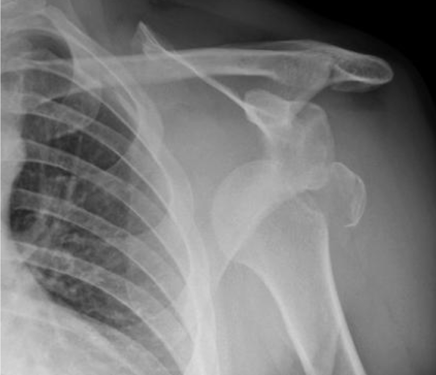 <p>What is the dx</p>