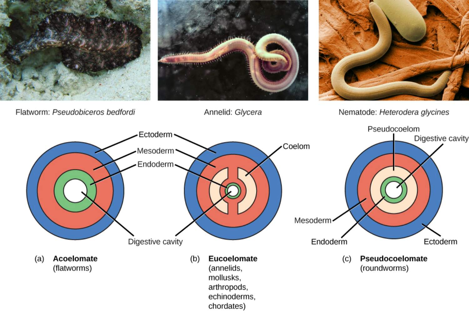 <p>fluid filled cavity between digestive tube and body wall </p><p>aceloem , no cavity present </p><p>true celoem, cavity lined with mesoderm on both sides</p><p>psuedo ceoloem - cavity lined with mesoderm on outer surface, ecto derm on inner surface </p>