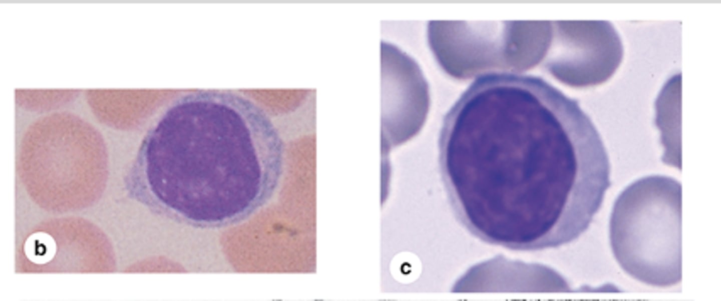 <p>How does the cytoplasm of larger lymphocytes appear?</p>