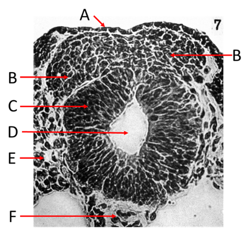 <ol><li><p>Label A, B, C, D, E and F</p></li><li><p>What view is this?</p></li></ol><p></p>