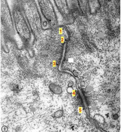 <p>identify the junctional complex component btwn 1 and 2</p>
