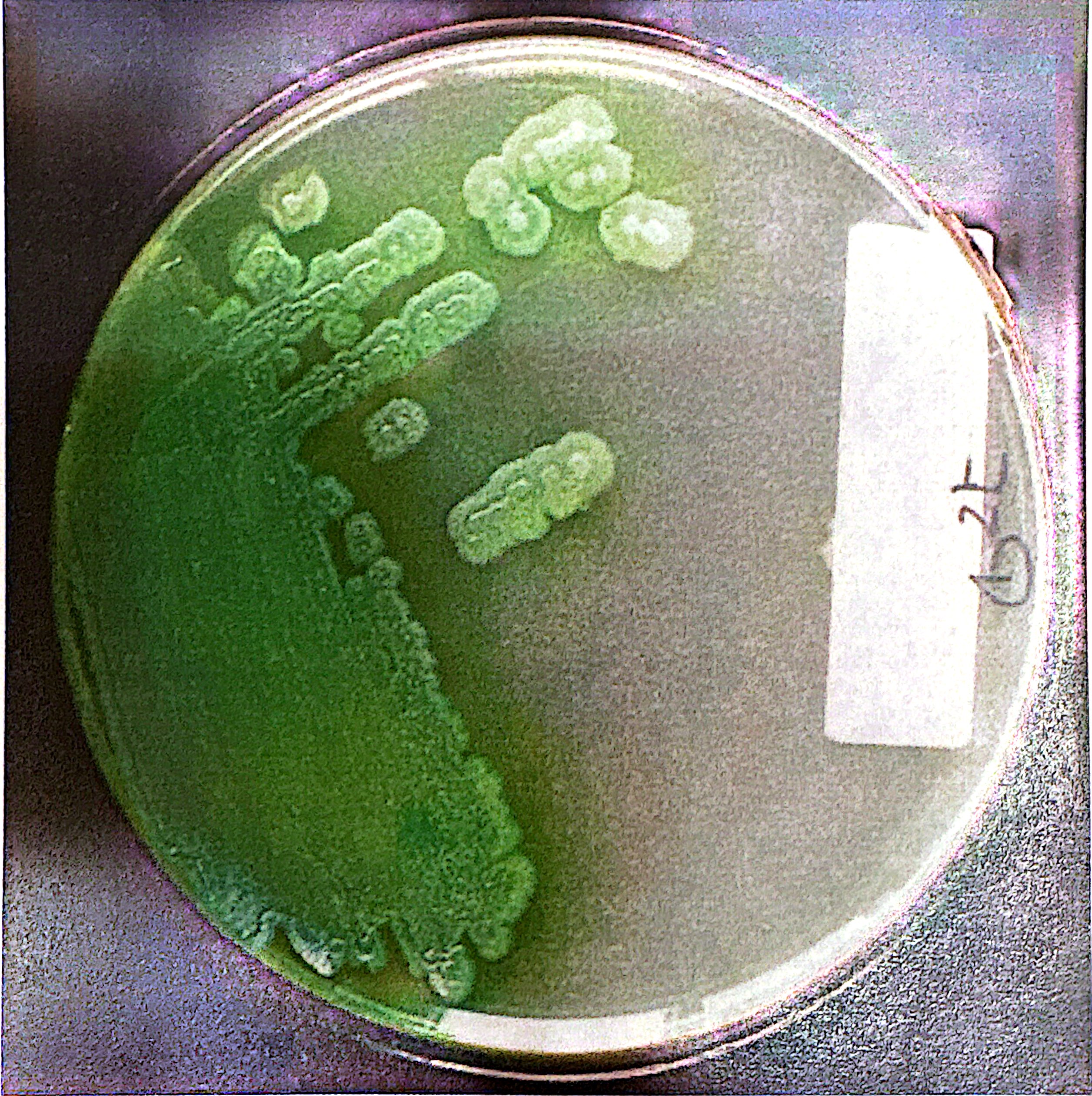 <p>The pigment has spread into the water-based agar. Can be blue, green, or green-yellow pigments </p>