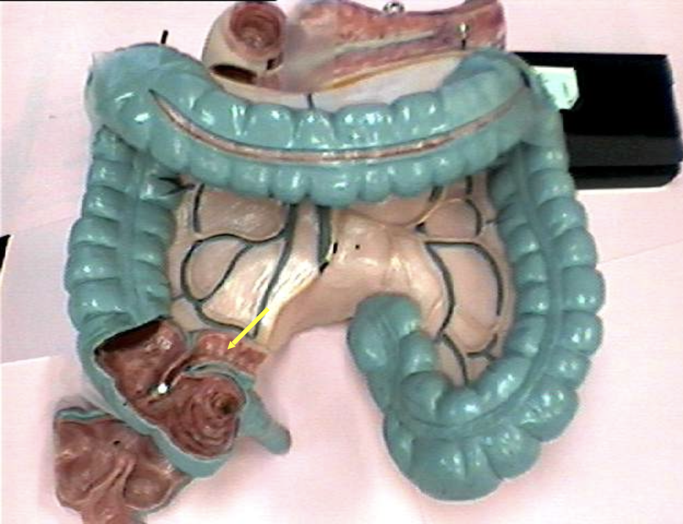 <p>Identify the organ.</p>