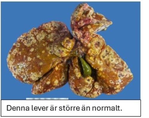 <p><strong>Kombinera det makroskopiska utseenden hos respektive lever (A-D) med trolig diagnos.</strong></p><p class="p1"><strong>Dra rätt alternativ till ”diagnos” för respektive bild. Endast ETT alternativ per</strong></p><p class="p1"><strong>makroskopiskt utseende. (2p)</strong></p>