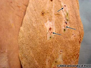 <p>what structure is noted on the inside of the liver?</p>