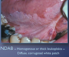 <p>Thin (pictured)</p><p>Thick</p>
