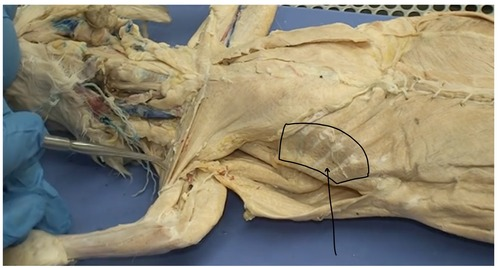 <p>What muscle is this?</p>