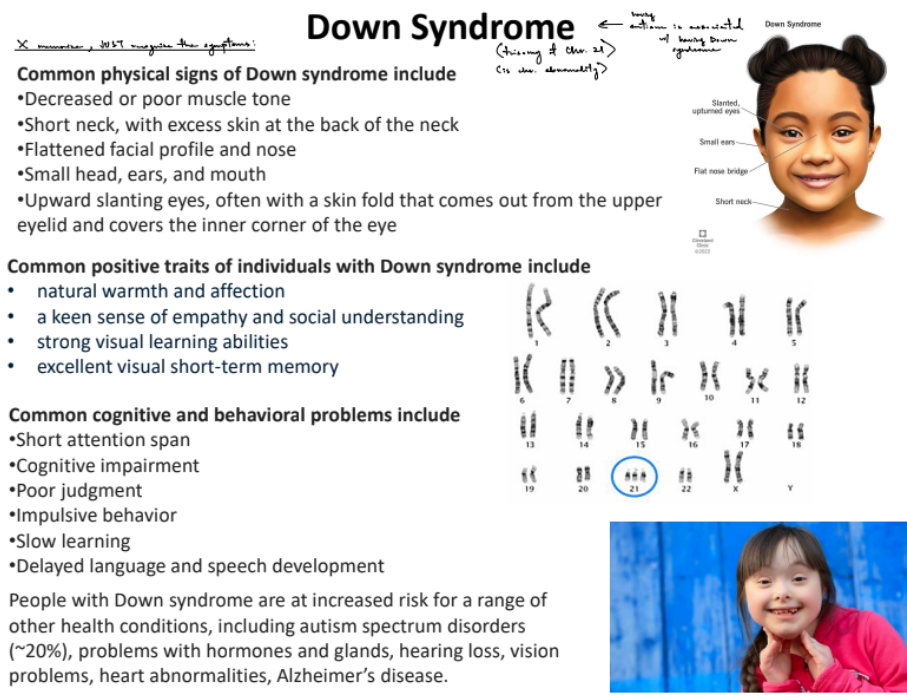 <p>Down’s syndrome is syndromic to ASD and/or ID, where Down’s syndrome is a <u>genetic abnormality</u>, specifically a very <u>common chromosomal abnormality</u> (b/c have trisomy Ch. 21)</p><p>all 4 are true</p>