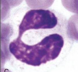 <p><span>Which type of white blood cell is shown in this picture? What are the characteristics of this type of white blood cell?</span></p>