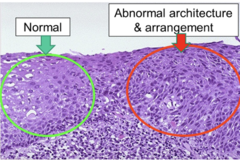 <p>What is the mechanism of hyperplasia?</p>