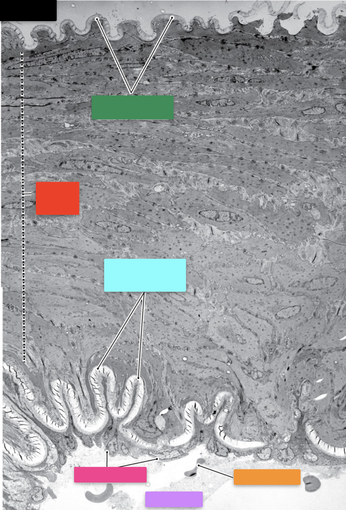 <p>Identify the structure indicated by the blue box</p>
