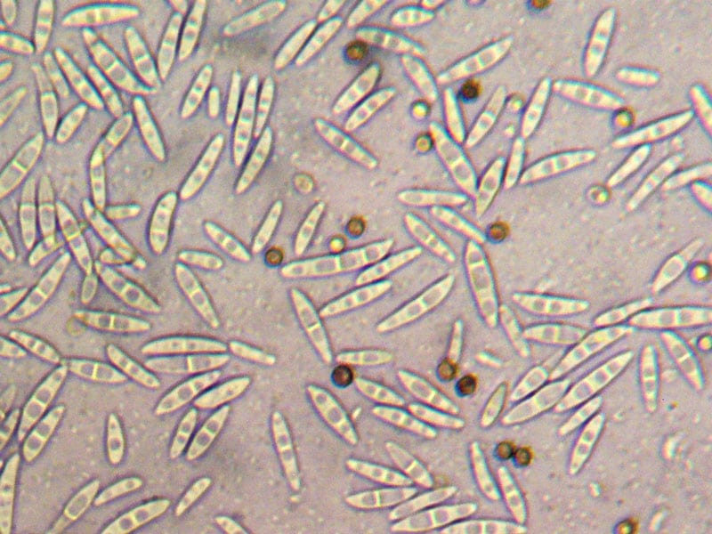 <p>Fusarium</p>