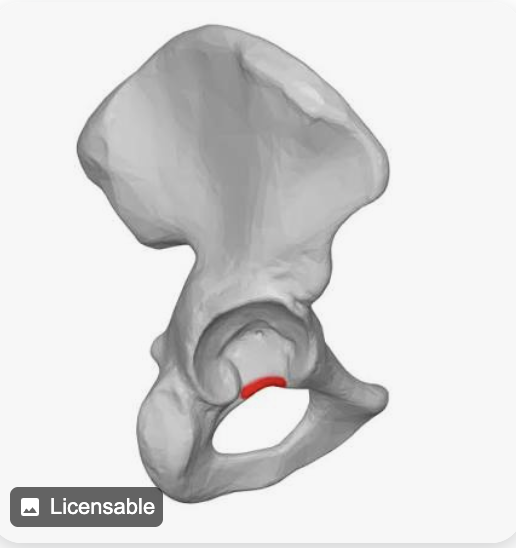 <p>Name this part of the pelvis</p>