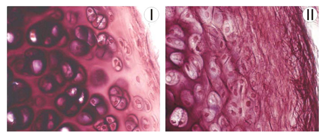 <p> Specify the type of tissue seen in the two pictures </p><p>A15) Tissue I</p>