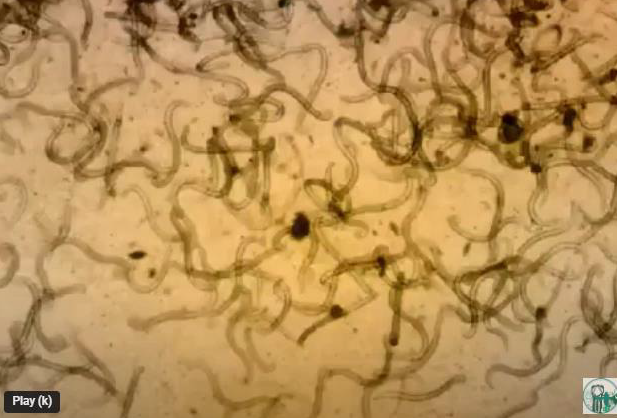 <p><span style="color: blue;"><em>Dictyocaulus: </em>Diagnosis</span></p>