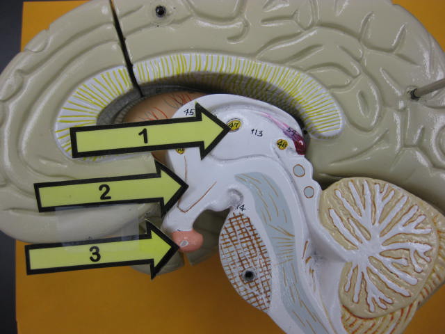 <p>Identify 1, 2 and 3? </p><p>Lab Image 10-7</p>