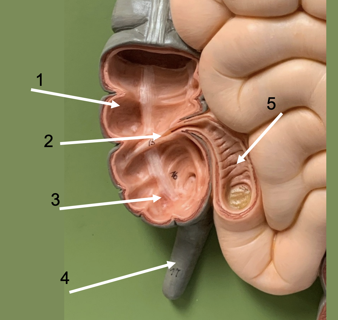 <p>ID 1, 2 (valve), 3, 4 ,51</p>