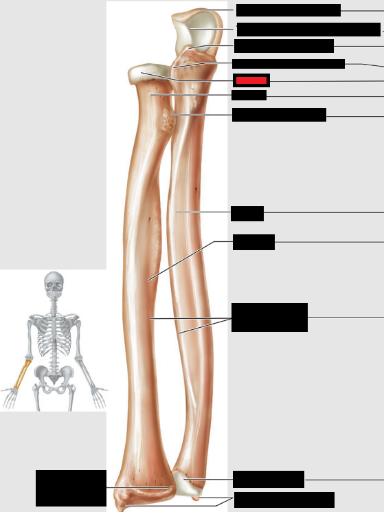 <p>Which part of the forearm is this?</p>
