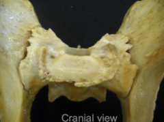 <p>what aspect of the sacroiliac joint is shown here</p>