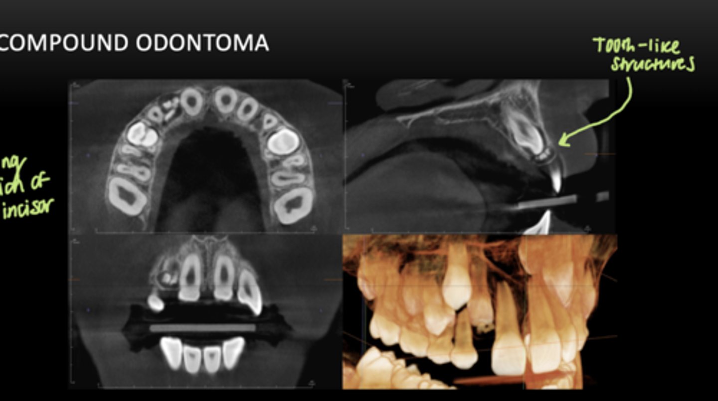 <p>Little tooth-like structures</p>