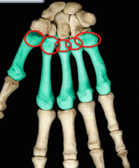 <p>Expanded proximal end that articulates with carpals</p>