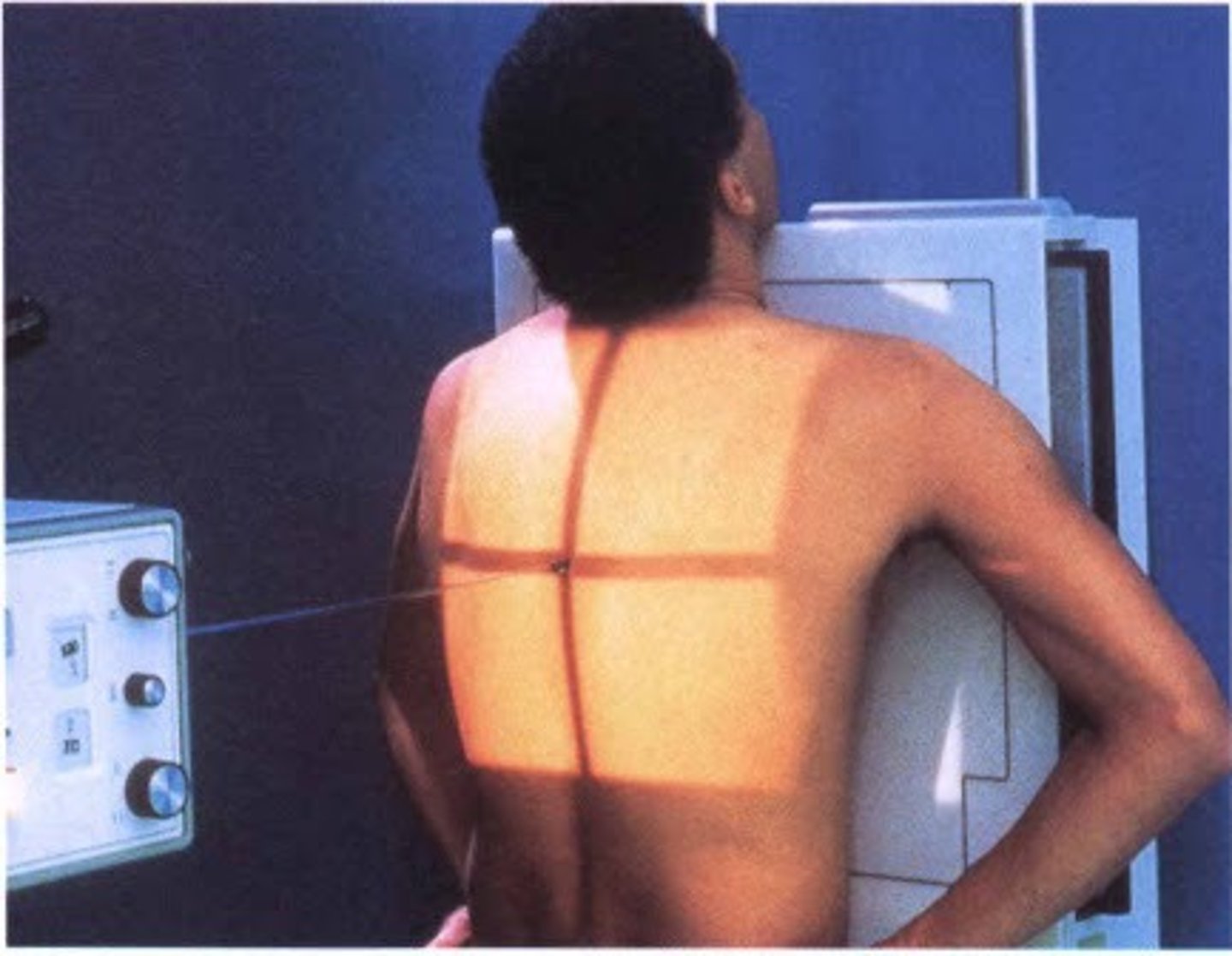 <p>S - shield around waist</p><p>T - 2 mAs @ 110 kVp</p><p>A - none</p><p>M - correct marker above shoulder</p><p>P - PA w/ hands on lower hips & shoulders rolled forward, chin raised slightly, CR T7</p><p>S - 72"</p><p>B - deep breath in, out, in and hold</p><p>C - 14 x17 lengthwise</p>