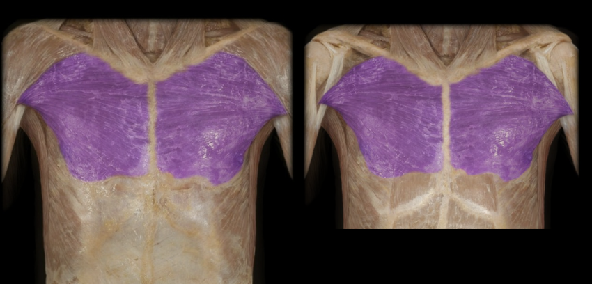 <p>What the highlighted structure is acting on the<strong> <mark data-color="#f7d3d3" style="background-color: rgb(247, 211, 211); color: inherit;">humerus</mark></strong>. What muscle is this called?</p>