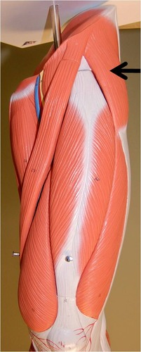 <p>Insertion</p>