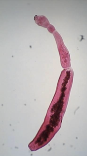 <p>Echinococcus granulosus</p>