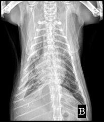 <p>Identify the opacity in the pleural space:</p><p>a. normal</p><p>b. air</p><p>c. soft tissue</p>