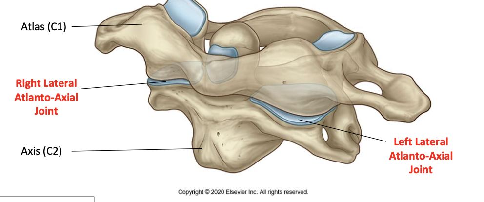 <p>Classification of lateral atlanto-axial joint</p>