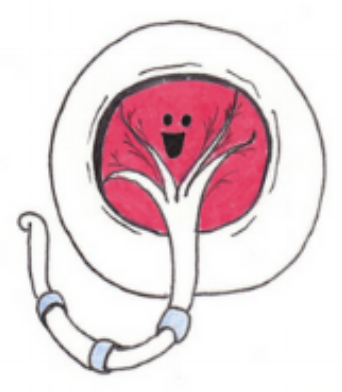<p>type of placenta?</p>