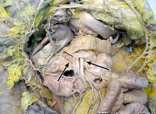 <p>what structure is being indicated to (be specfic)?</p>