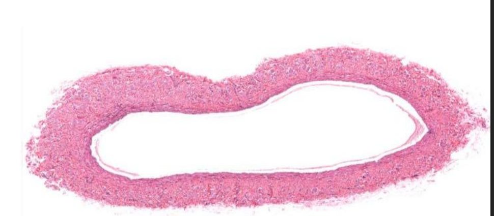 <p>Identify this vessel</p>