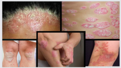 <p>What is this disease?</p>