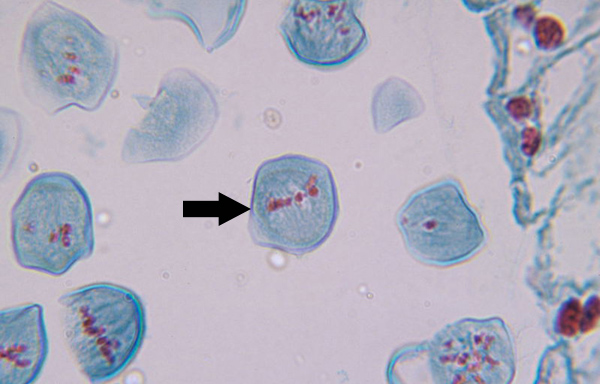 <p>Microtubules align homologous chromosome pairs along metaphase plate</p>