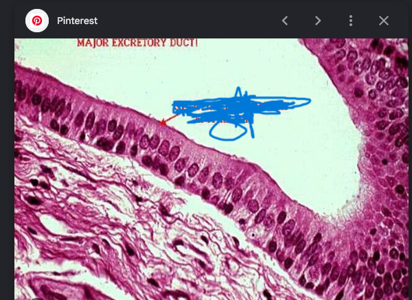 <p>what tissue type is this </p>