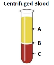 <p><span style="line-height: 17.375px;">Which layer contains white blood cells and platelets?&nbsp;</span></p>