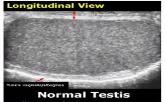 <p>Normal Testis</p>