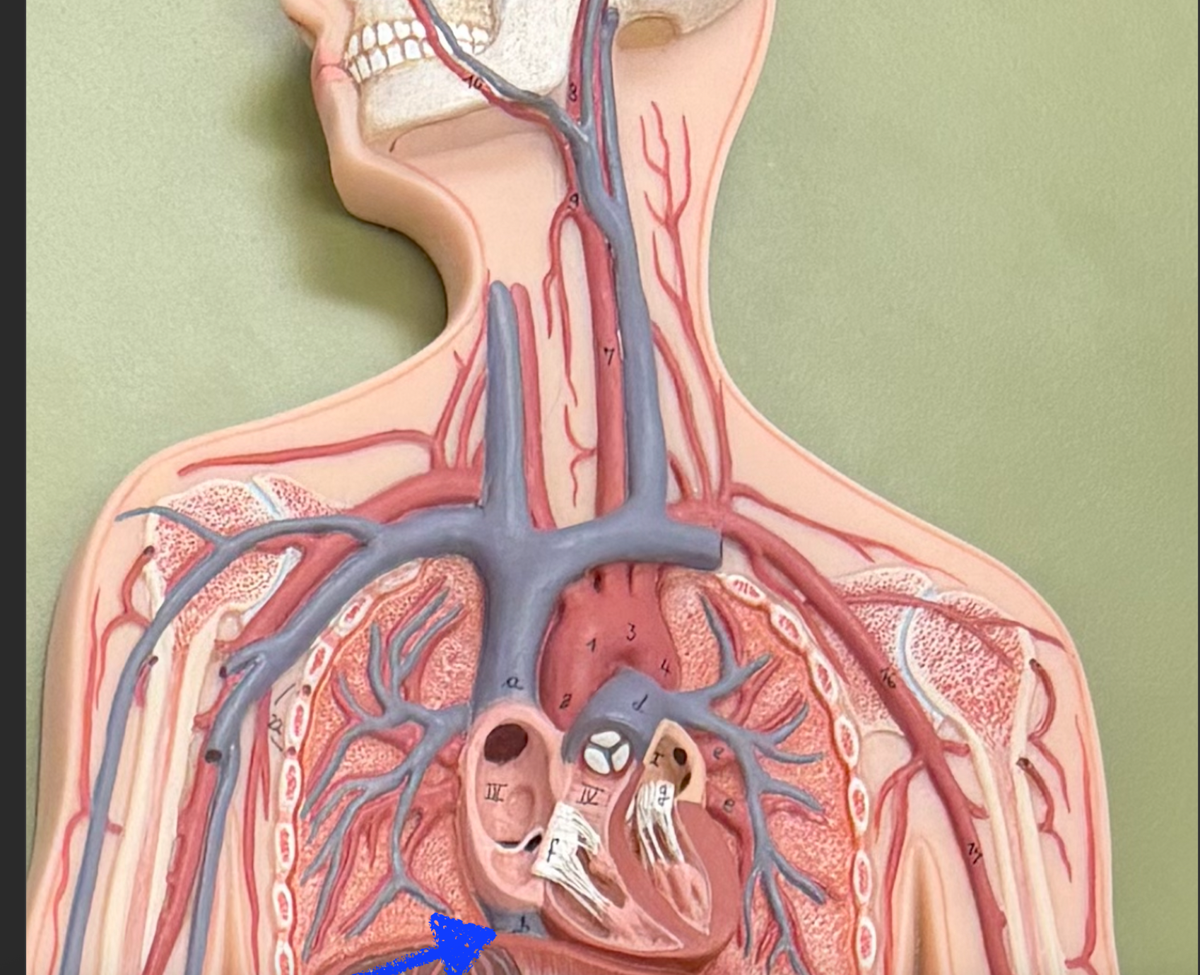 term image