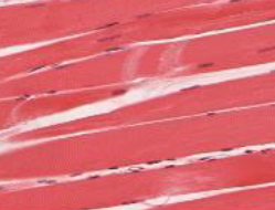 <p>skeletal muscle</p>