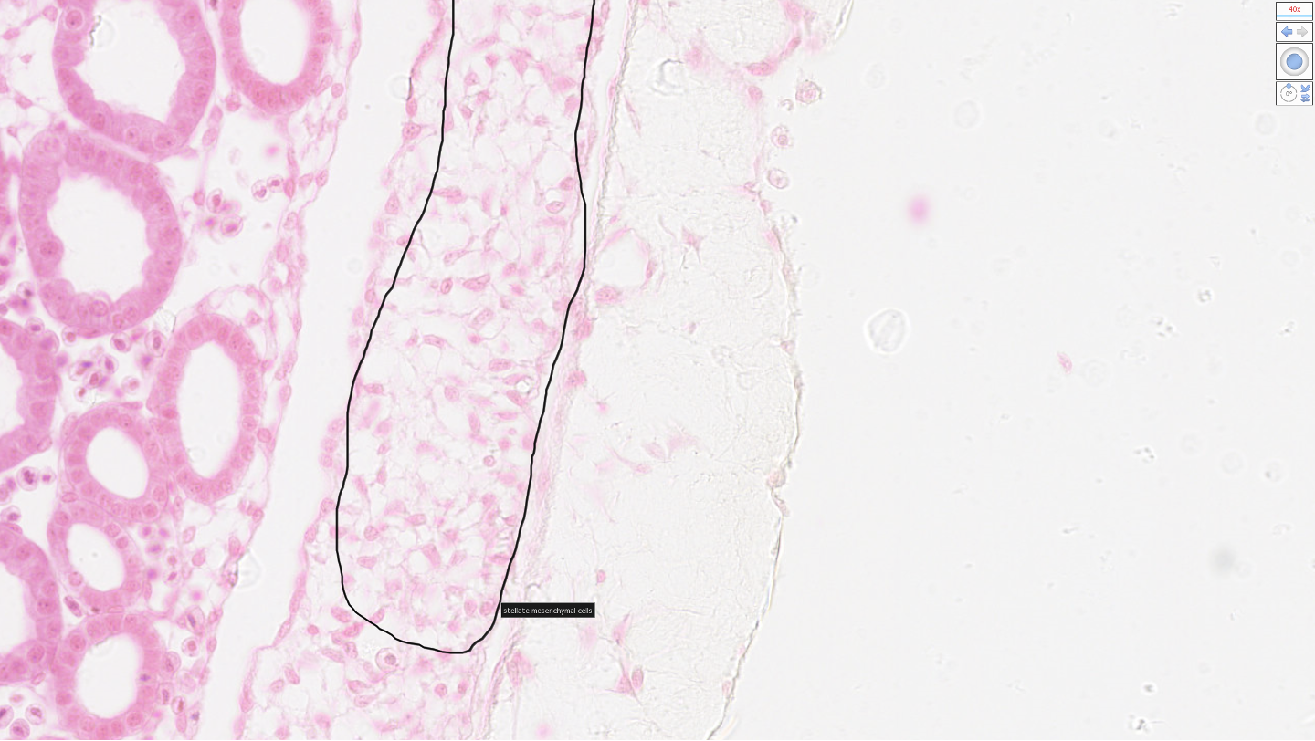 <p>mesenchymal stem cells</p>
