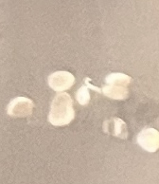 <p>What stage silkworm is this at?</p>